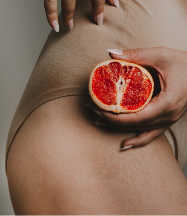 Cellulite 1
