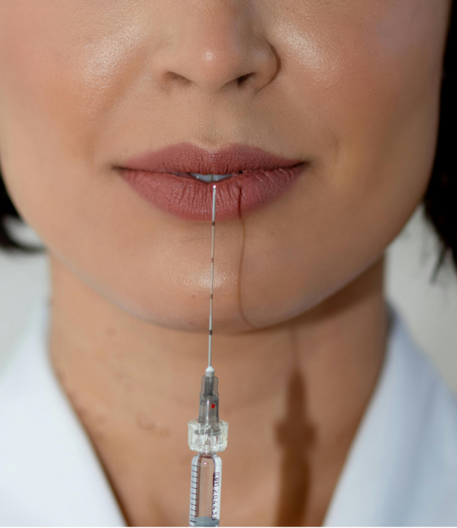 Lip injection 03